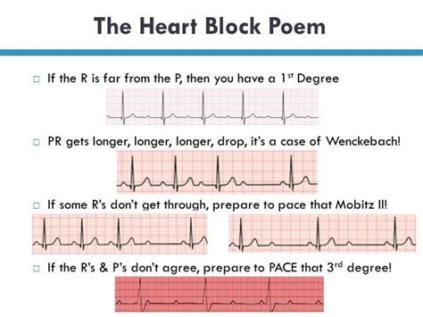 Heart Blocks: “The Heart Block Poem”. Heart blocks are abnormal heart rhythm where the heart beats too slowly. In. this condition, the electrical signals that tell that heart to contract are. partially or totally blocked between the upper chambers (atria) and lower. chambers (ventricles). 2. 